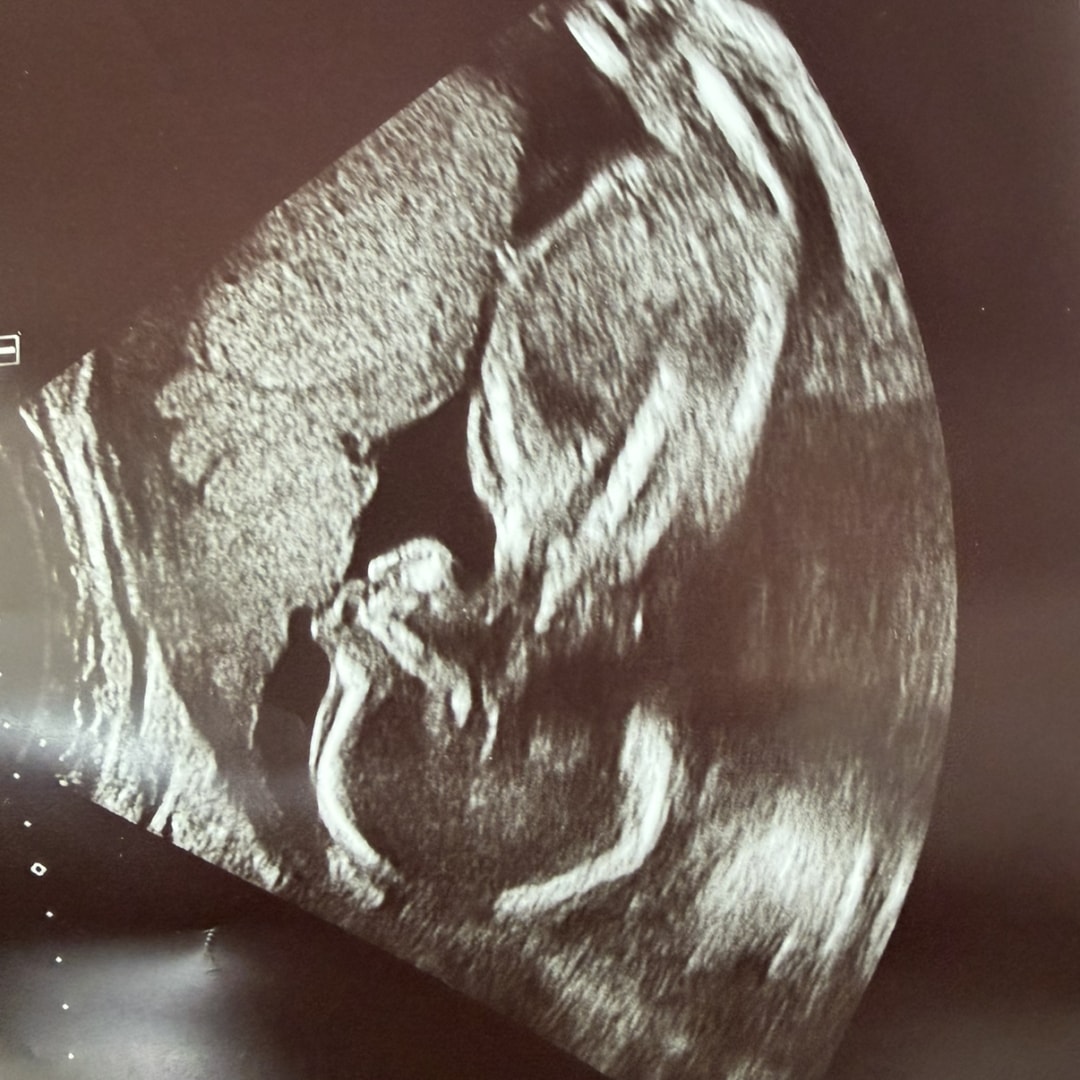 Photo shared by Mycalia for their Babylist baby registry.