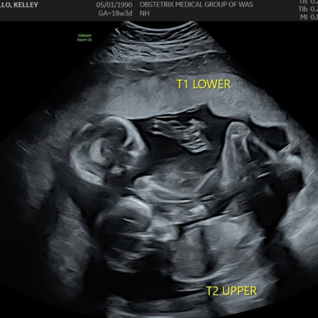 Photo shared by Kelley for their Babylist baby registry.