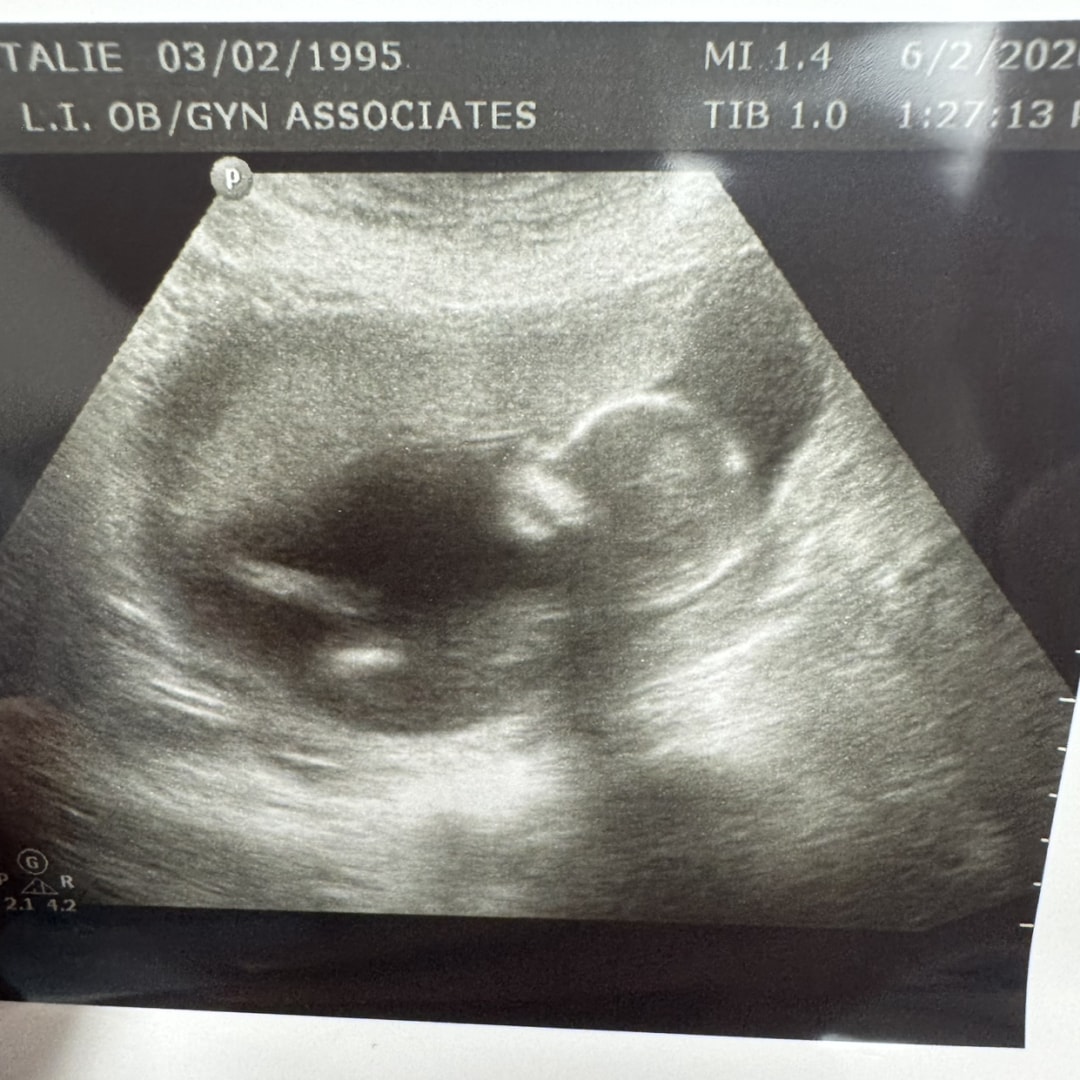 Photo shared by Natalie for their Babylist baby registry.