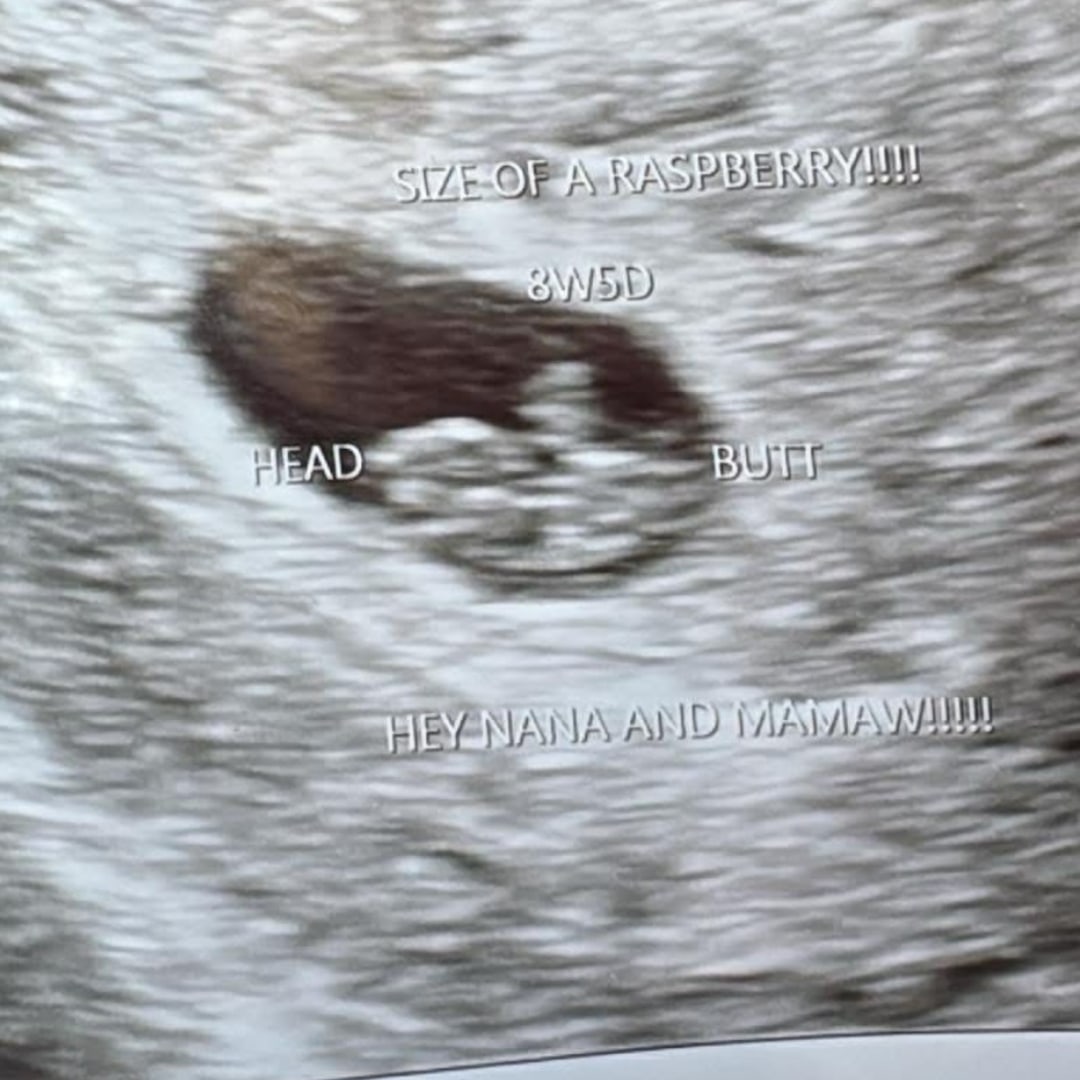 Photo shared by Noel for their Babylist baby registry.