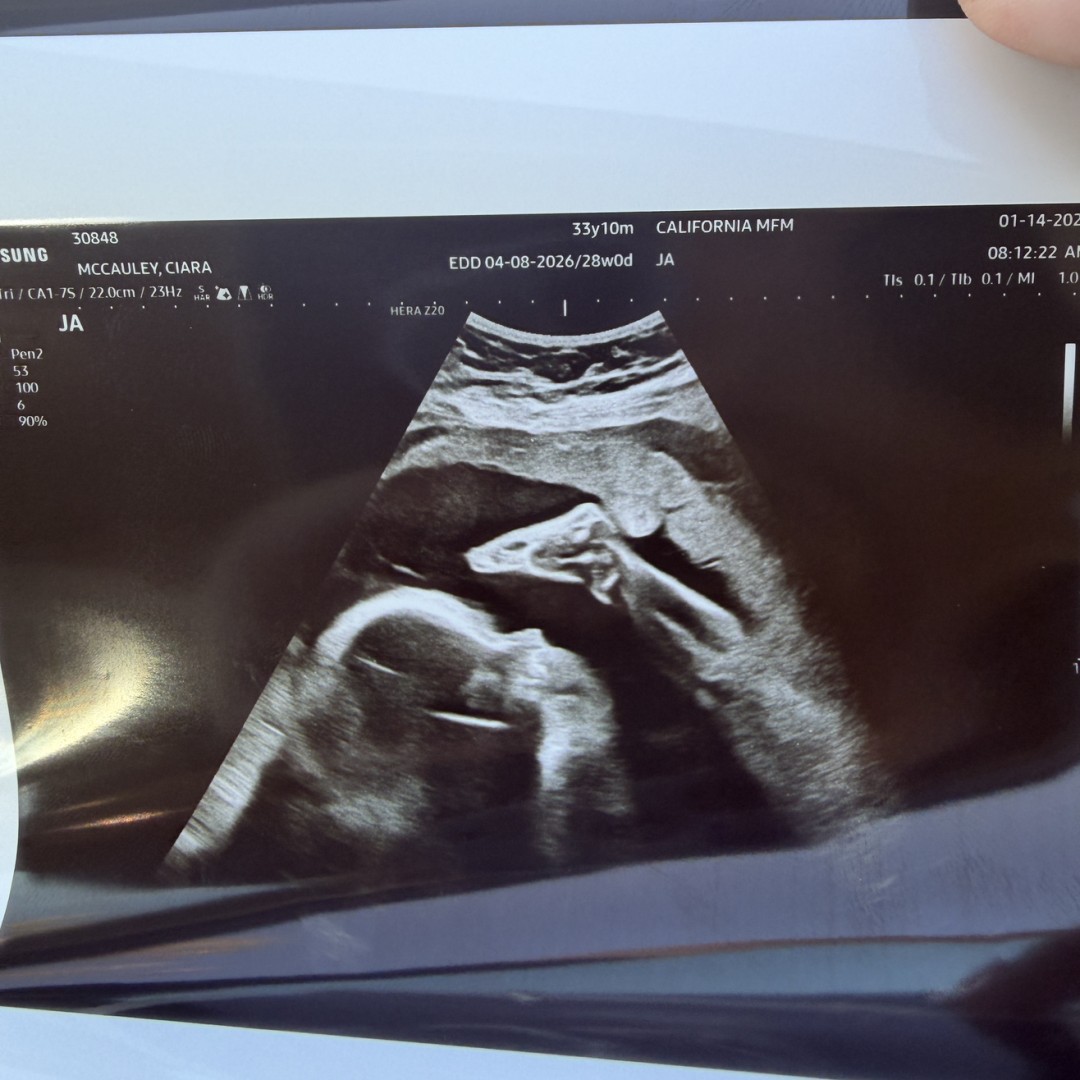 Photo shared by Ciara for their Babylist baby registry.