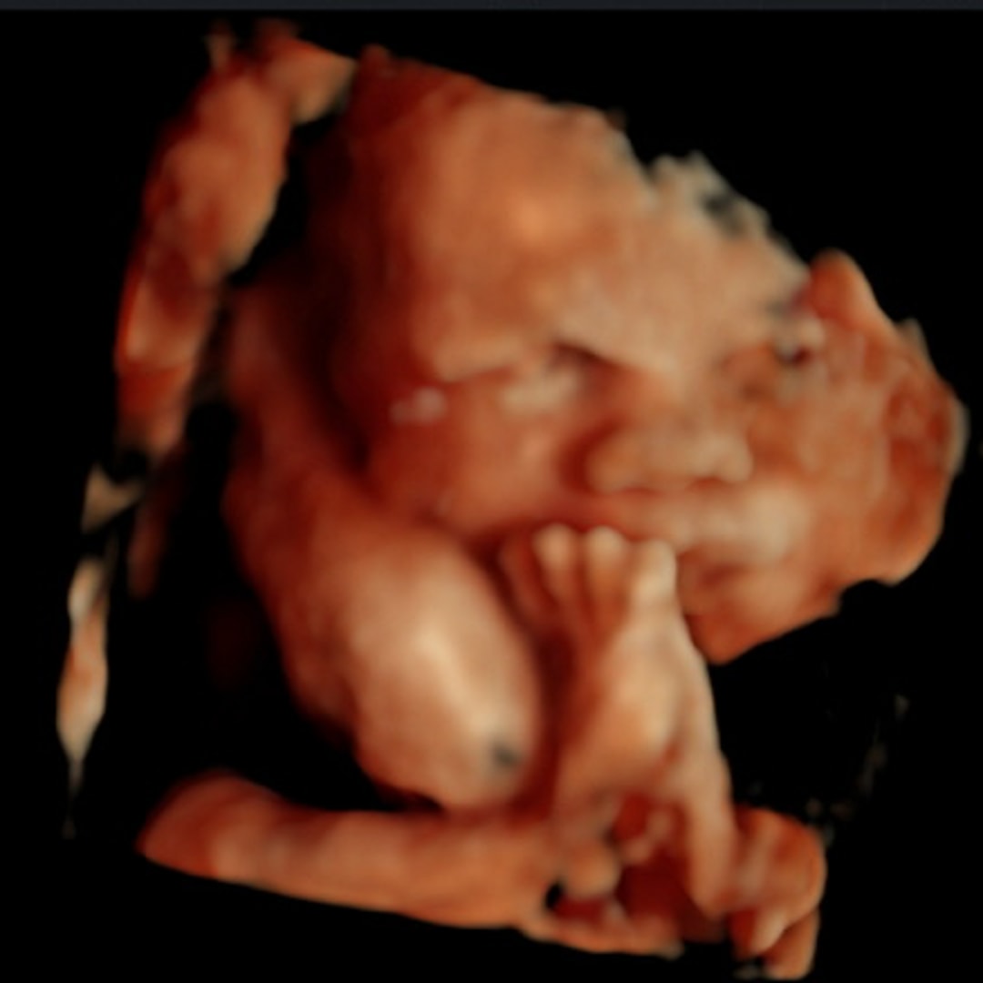Photo shared by Miriam for their Babylist baby registry.