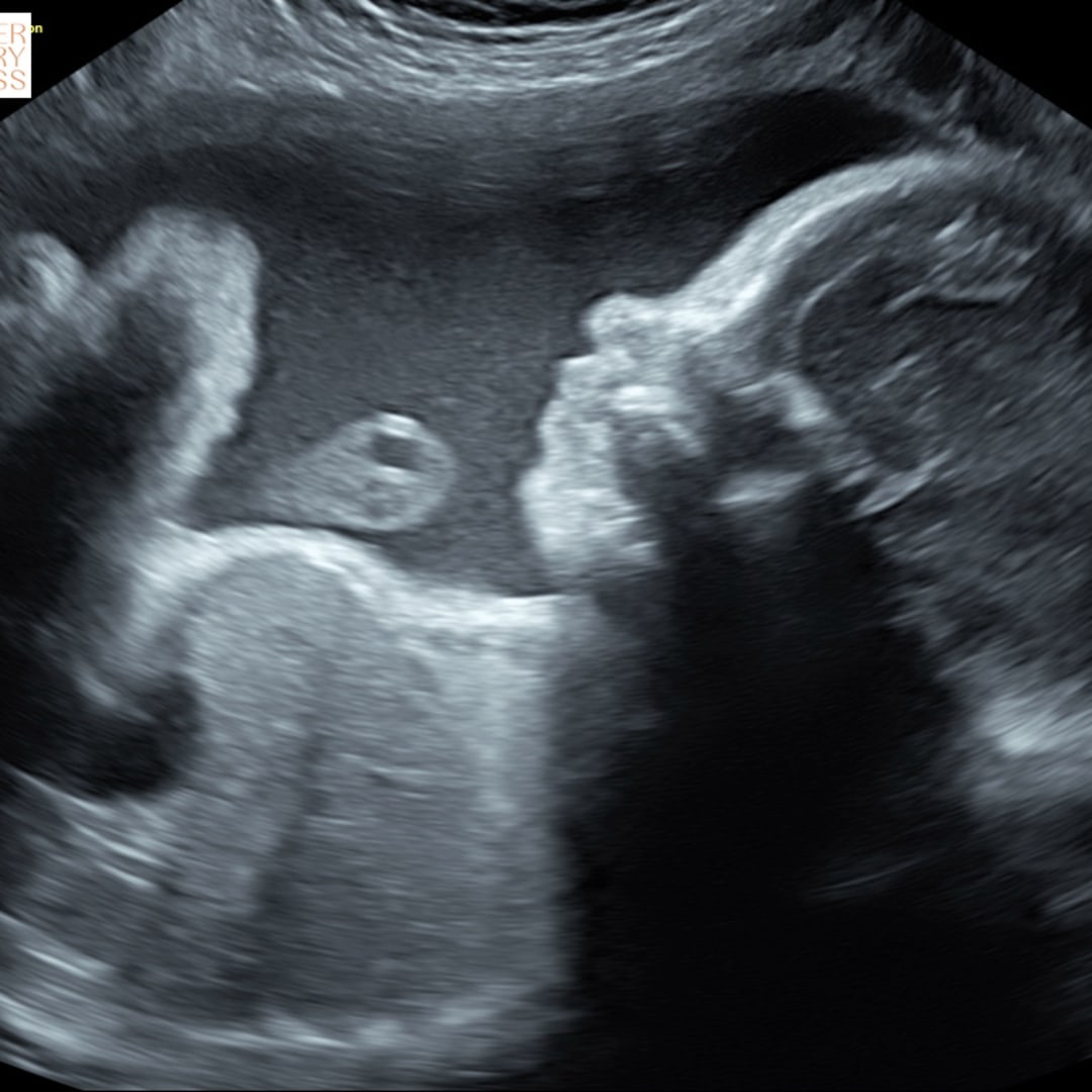 Photo shared by Morgan for their Babylist baby registry.