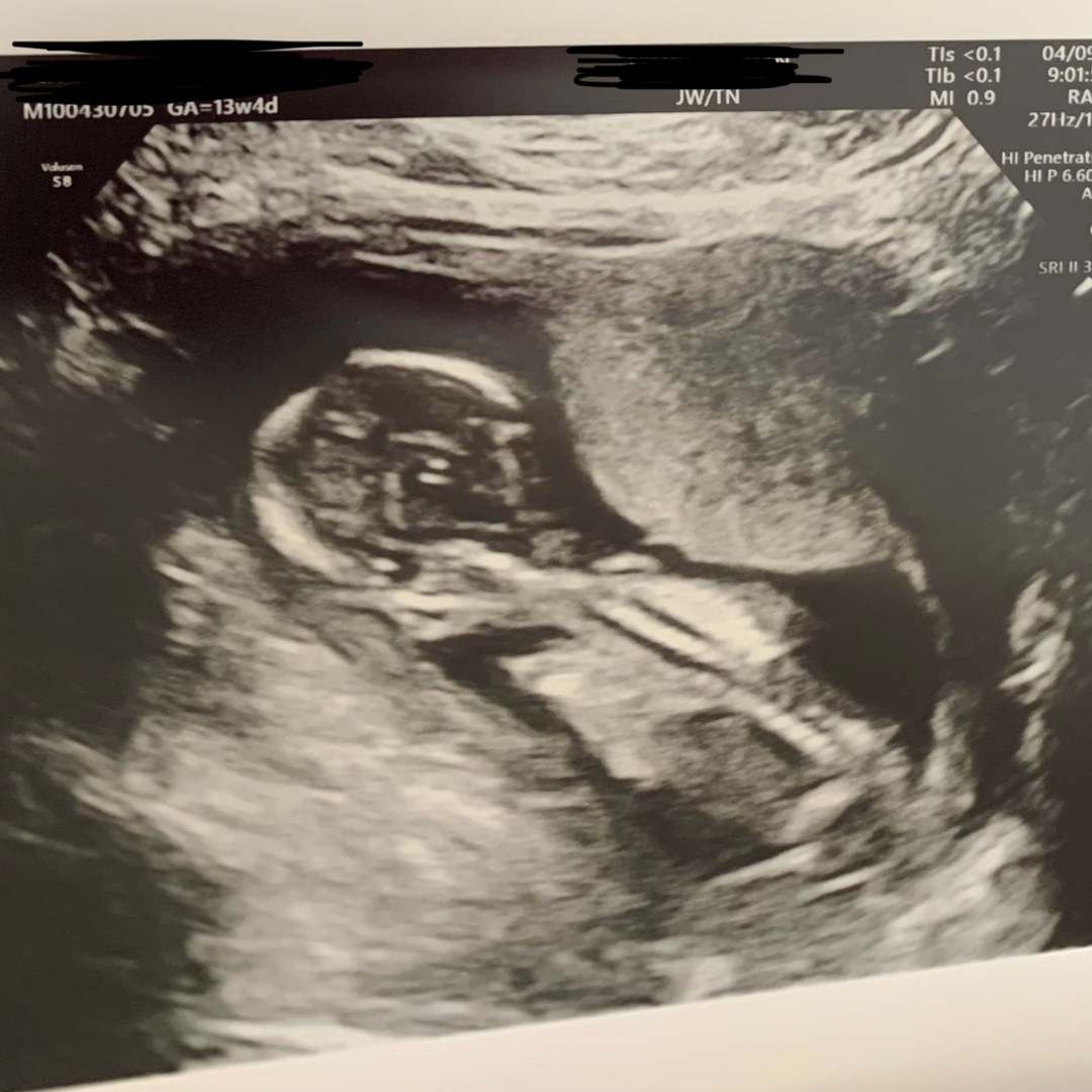 Photo shared by Jenna for their Babylist baby registry.