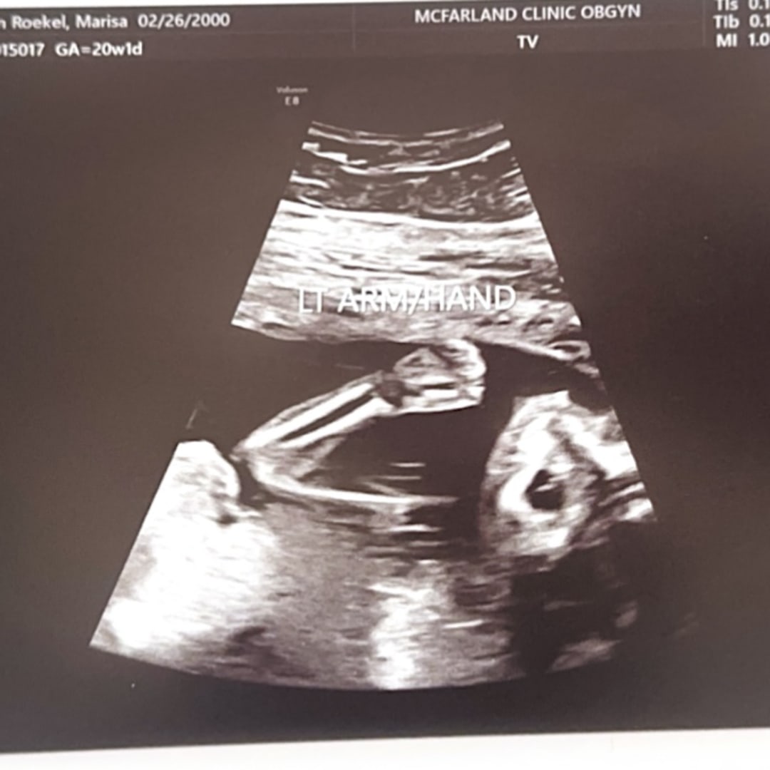 Photo shared by Marisa for their Babylist baby registry.