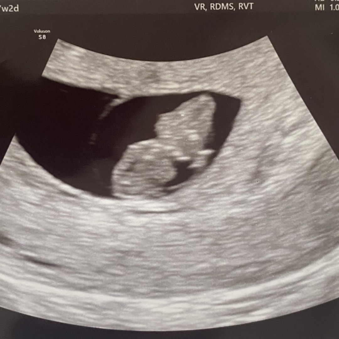 Photo shared by Caitlin for their Babylist baby registry.