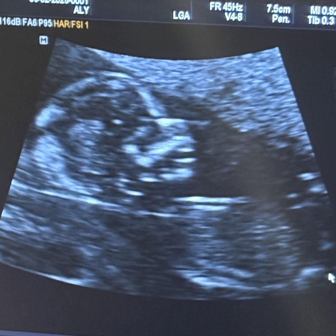 Photo shared by Aly for their Babylist baby registry.