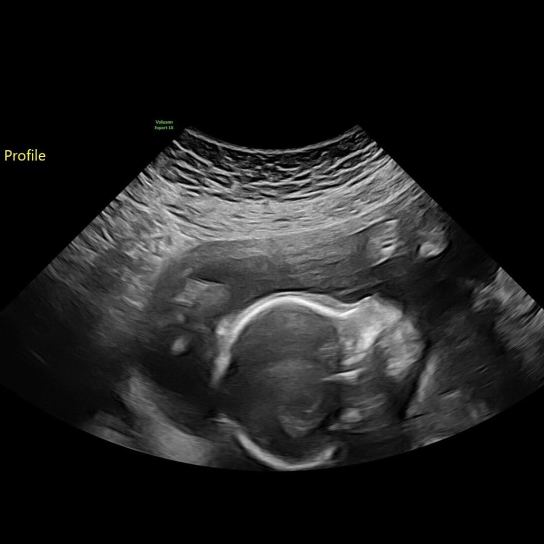 Photo shared by Samantha for their Babylist baby registry.