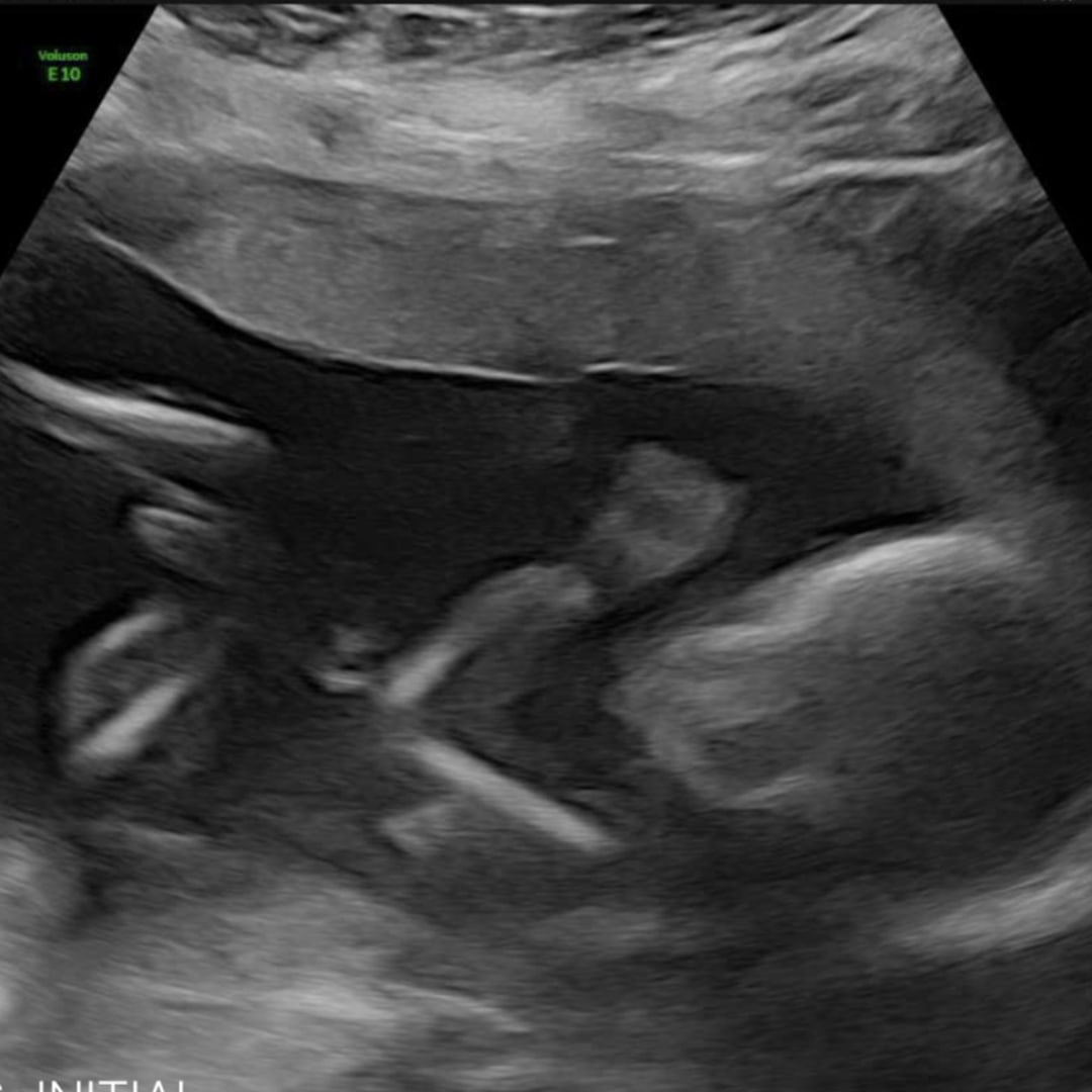 Photo shared by Jessica for their Babylist baby registry.