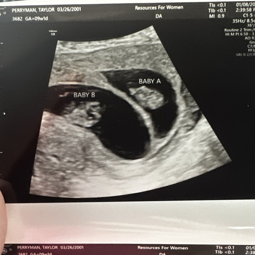 Photo shared by Taylor for their Babylist baby registry.