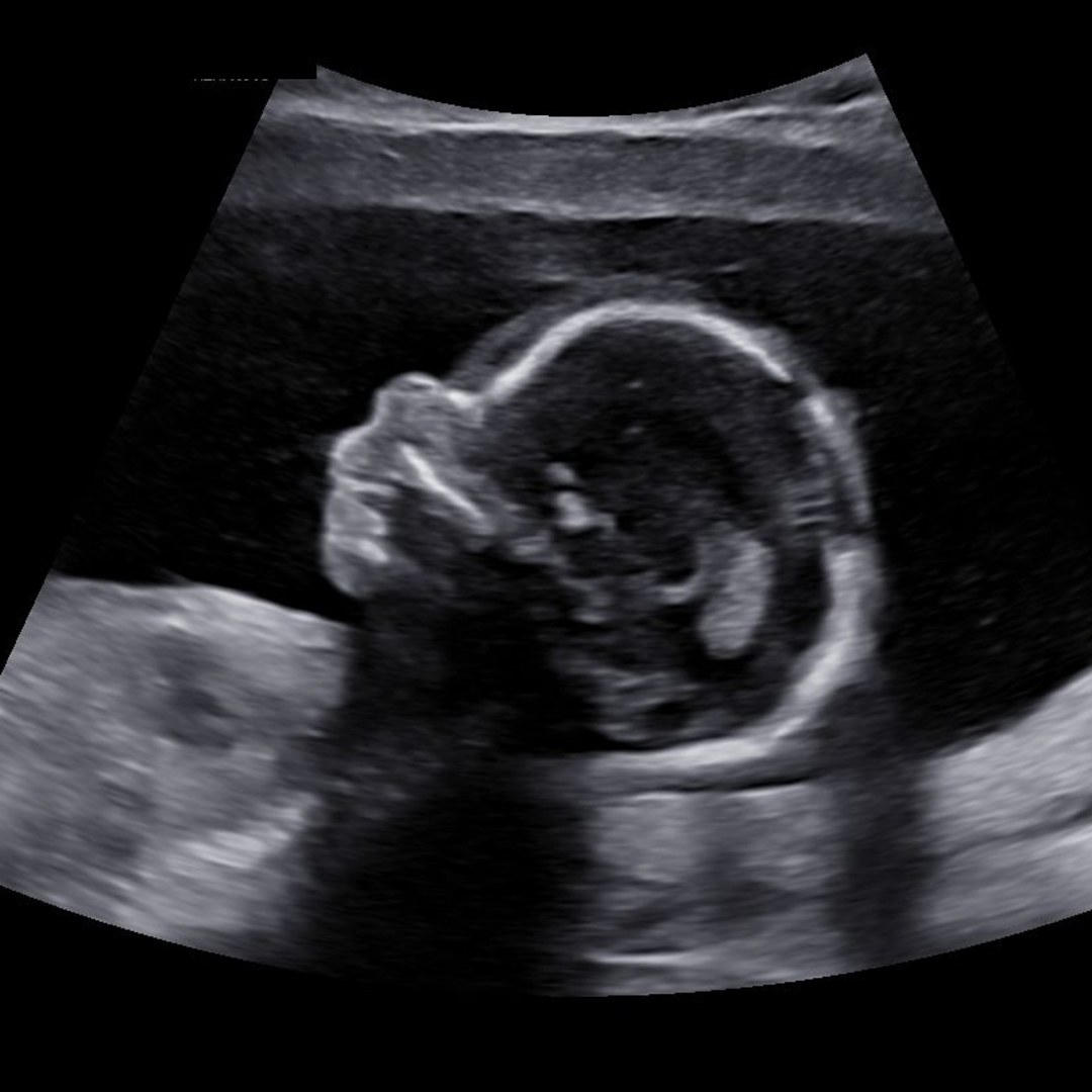 Photo shared by Jessica for their Babylist baby registry.