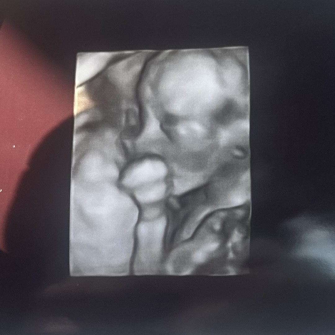 Photo shared by Lily and Adam for their Babylist baby registry.