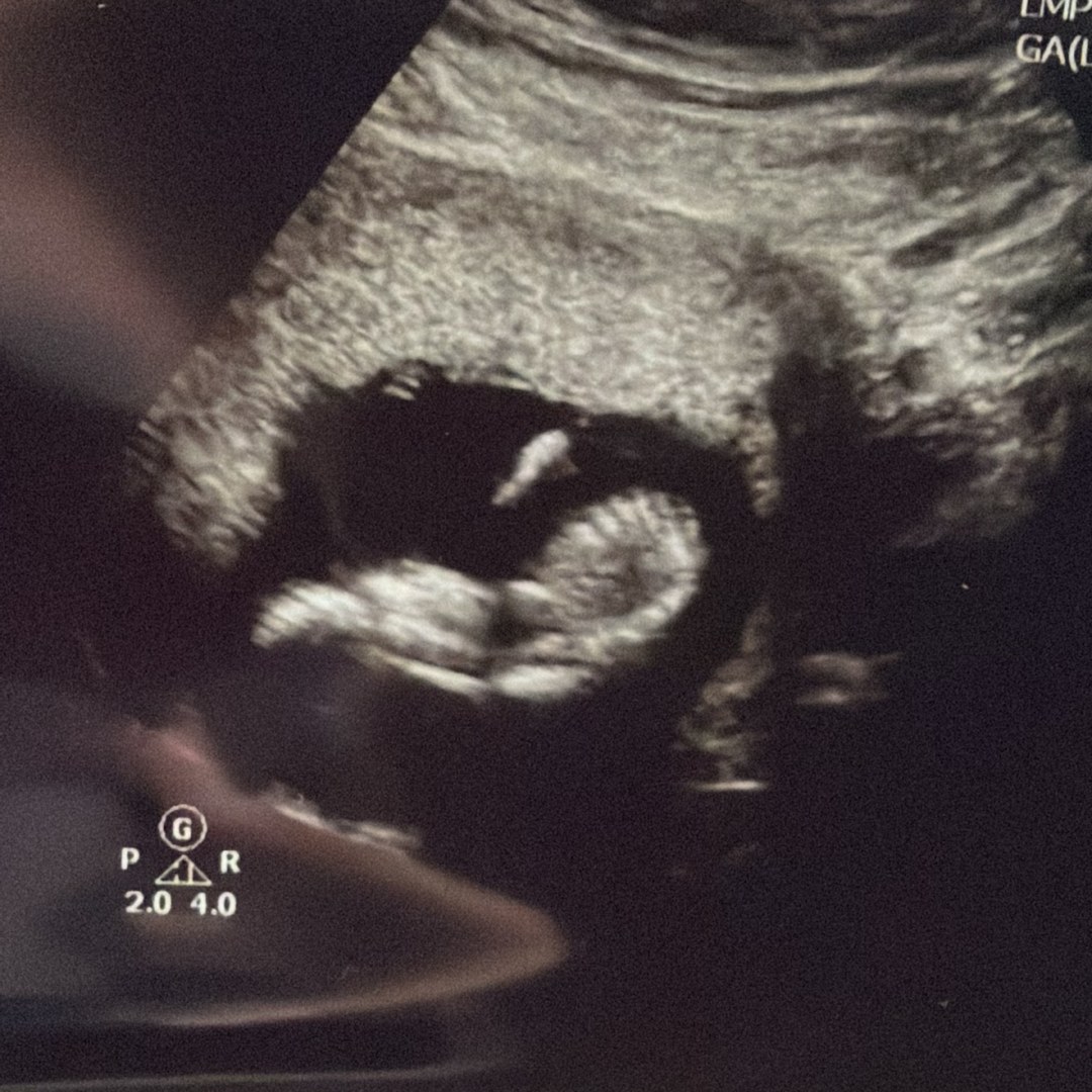 Photo shared by Annie for their Babylist baby registry.
