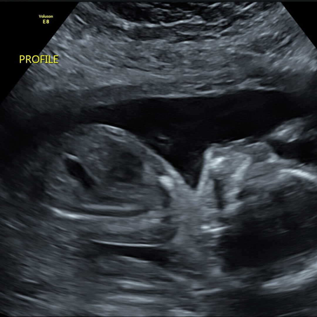 Photo shared by Emily for their Babylist baby registry.