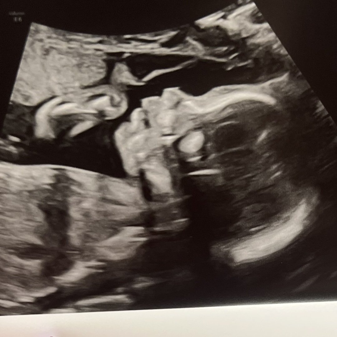 Photo shared by Jacquelyn for their Babylist baby registry.