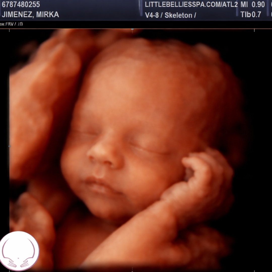 Photo shared by Mirka/Miguel for their Babylist baby registry.