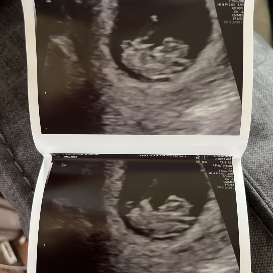 Photo shared by Julie for their Babylist baby registry.