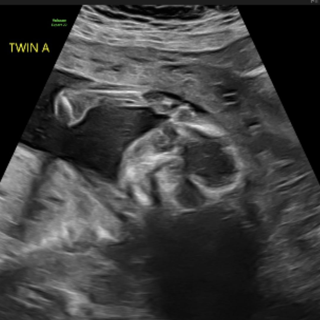 Photo shared by Christina for their Babylist baby registry.