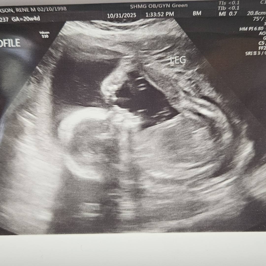 Photo shared by Rene for their Babylist baby registry.