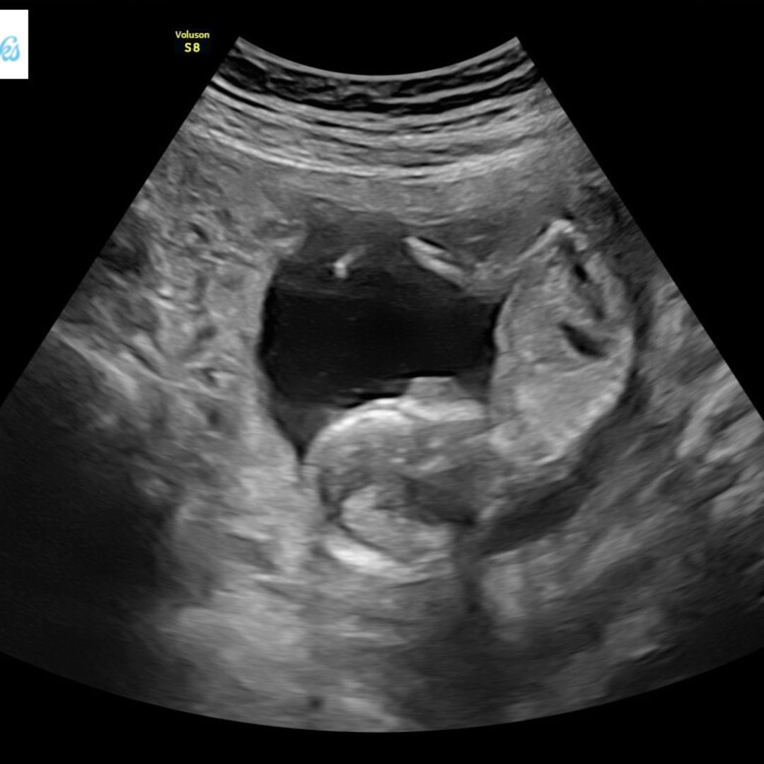 Photo shared by Jana for their Babylist baby registry.