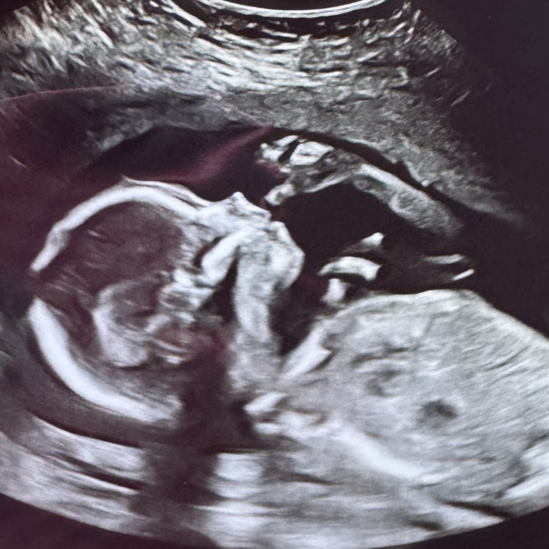 Photo shared by Courtney for their Babylist baby registry.