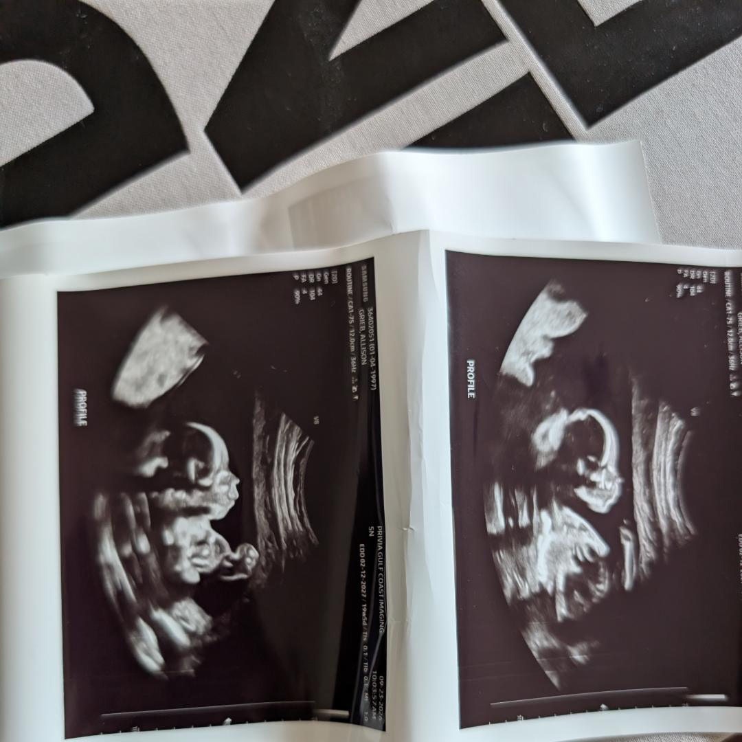 Photo shared by Allie for their Babylist baby registry.