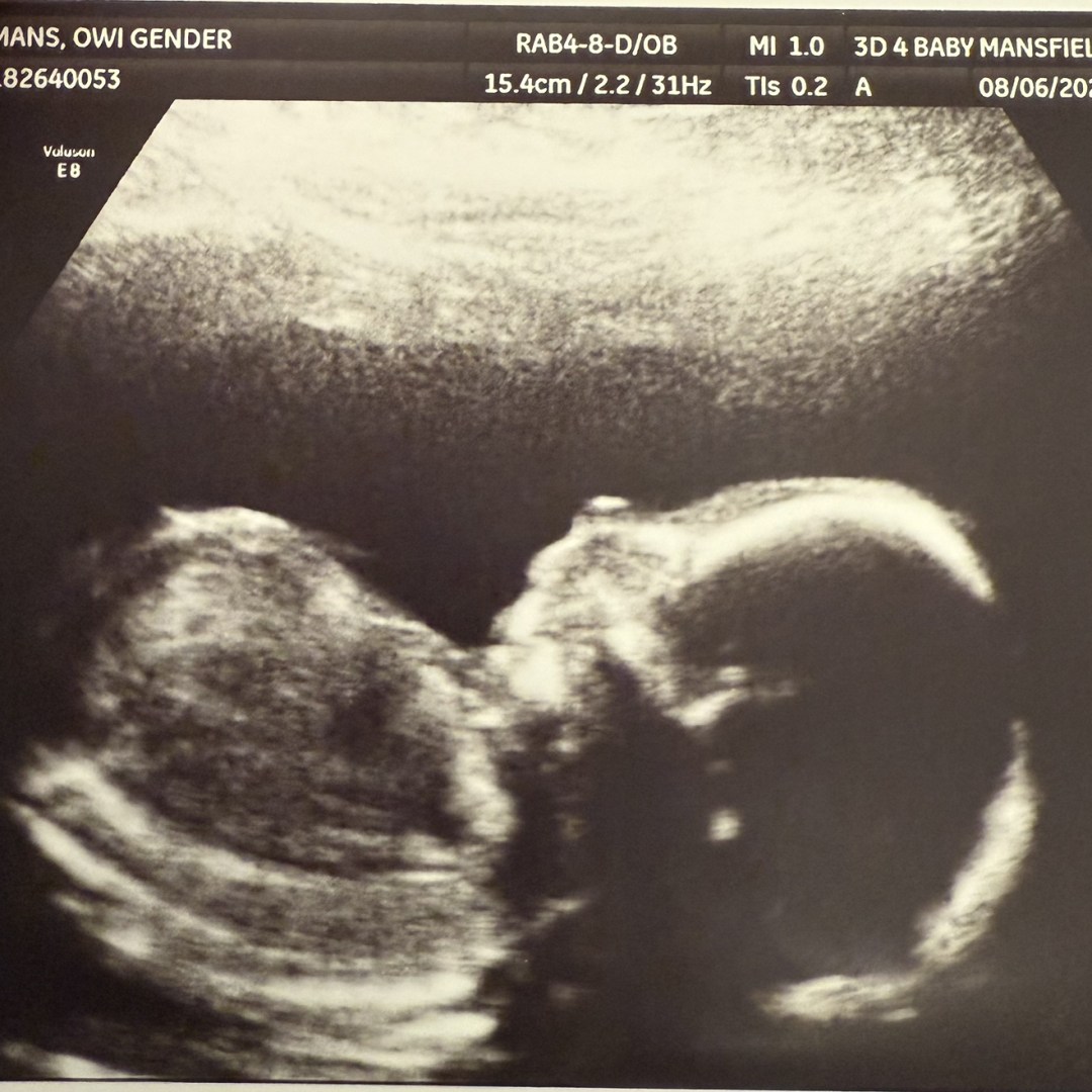 Photo shared by Olivia for their Babylist baby registry.