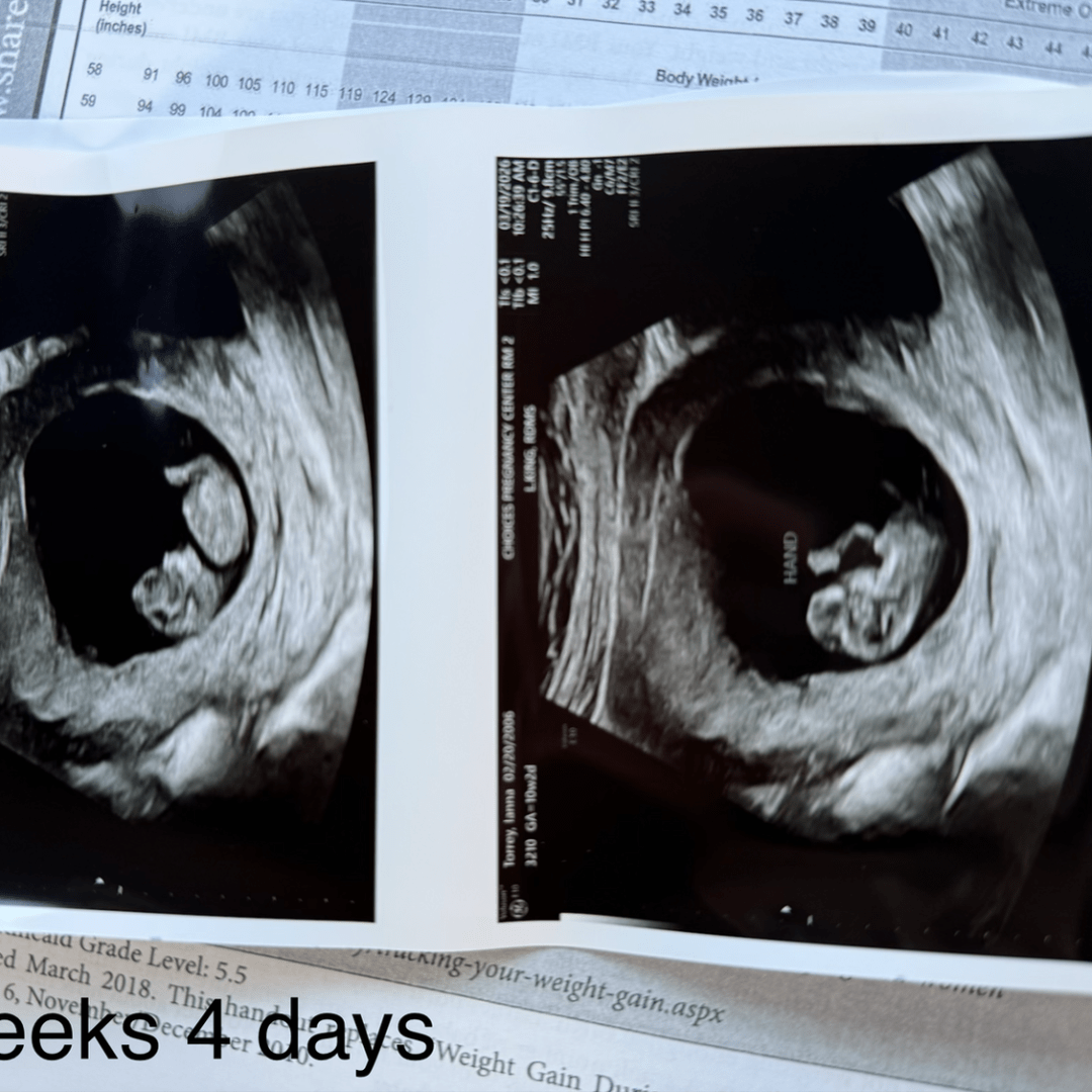 Photo shared by Ianna for their Babylist baby registry.