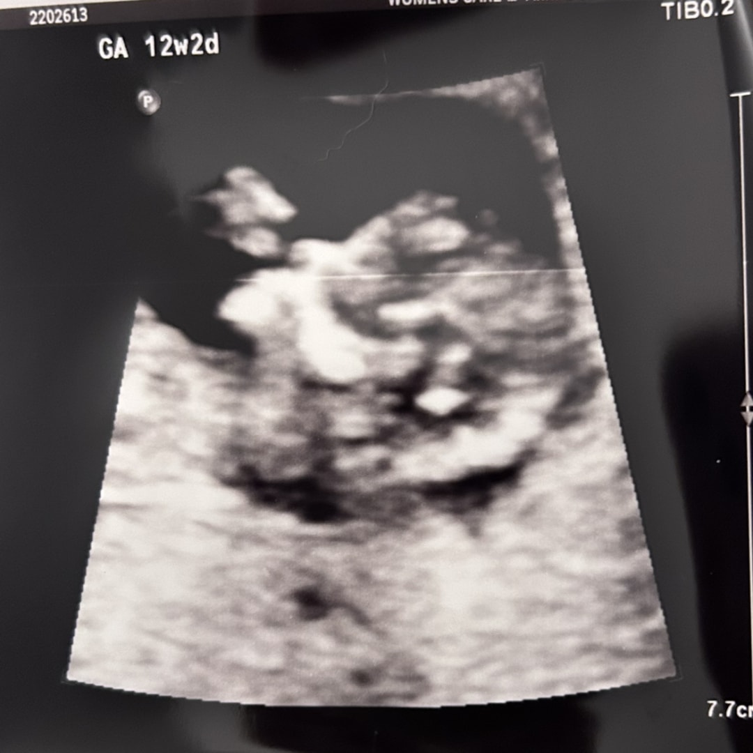 Photo shared by Aliana for their Babylist baby registry.