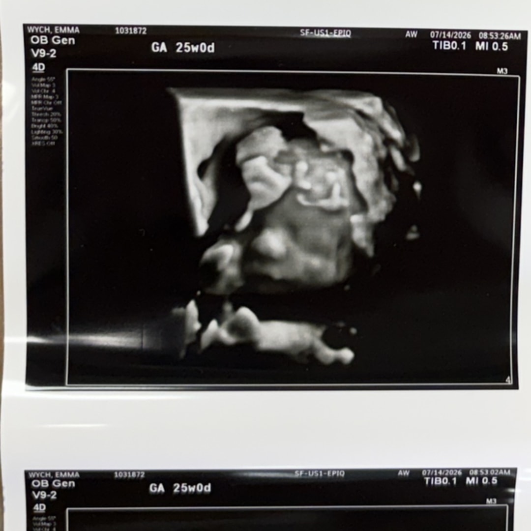 Photo shared by Emma Jo for their Babylist baby registry.