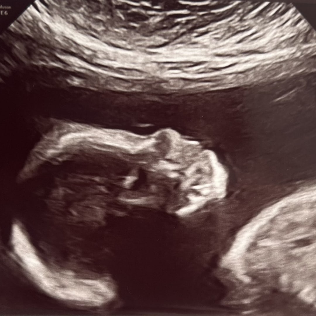 Photo shared by Leah for their Babylist baby registry.