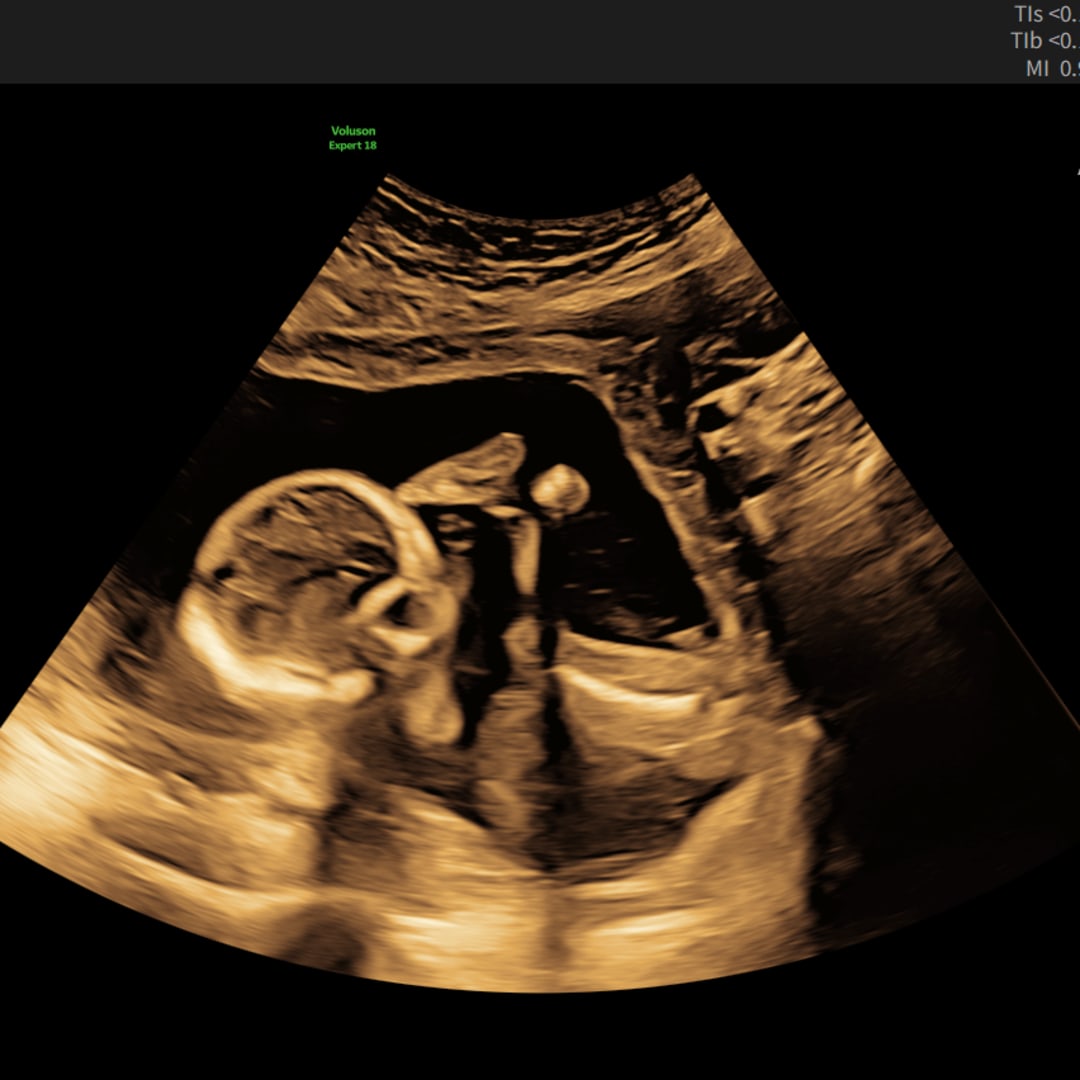 Photo shared by Zoe for their Babylist baby registry.