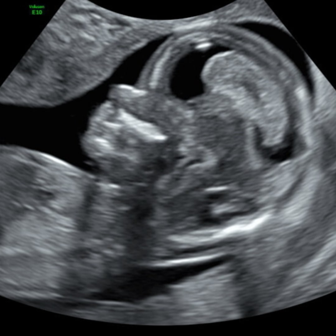 Photo shared by Gabriela for their Babylist baby registry.