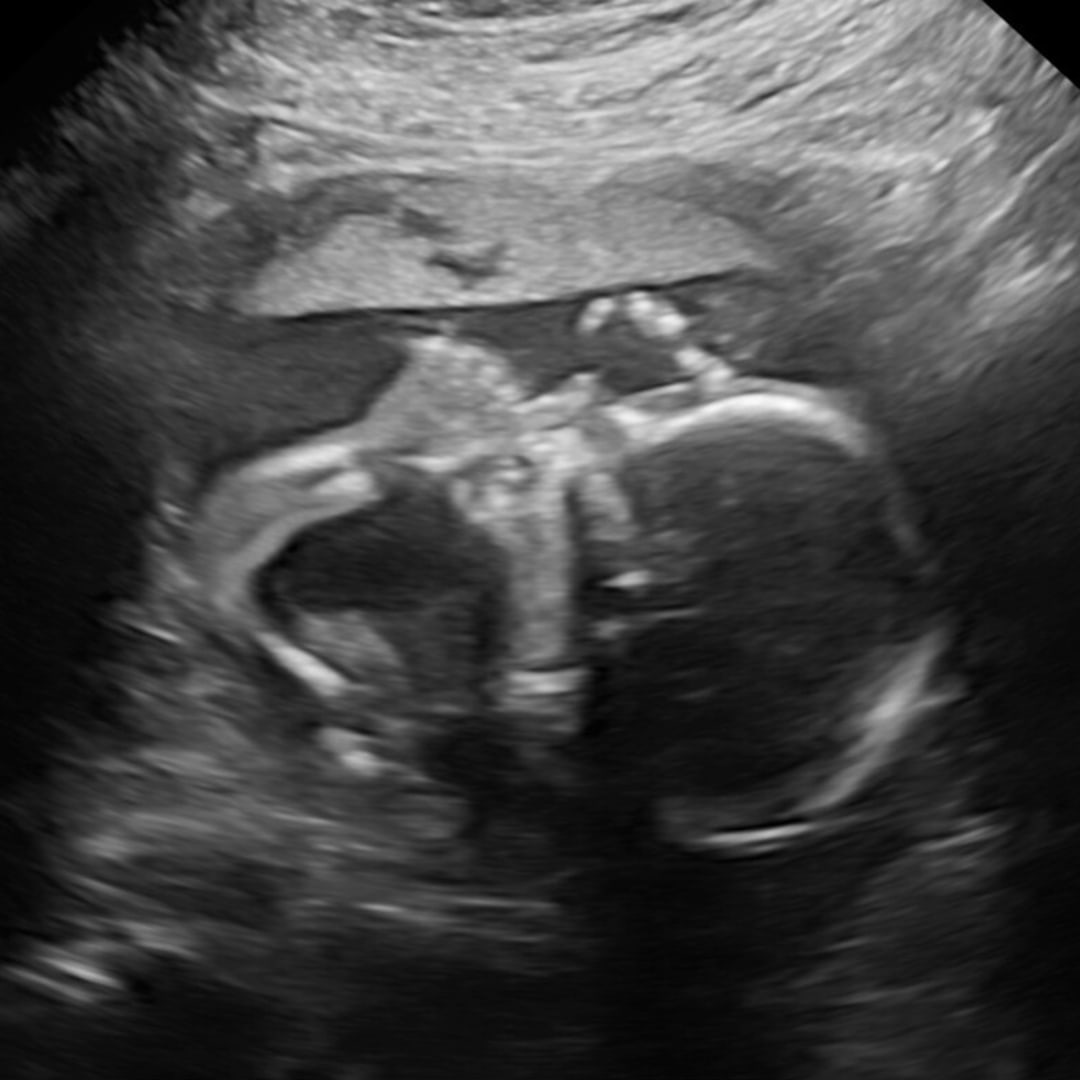 Photo shared by Hannah for their Babylist baby registry.