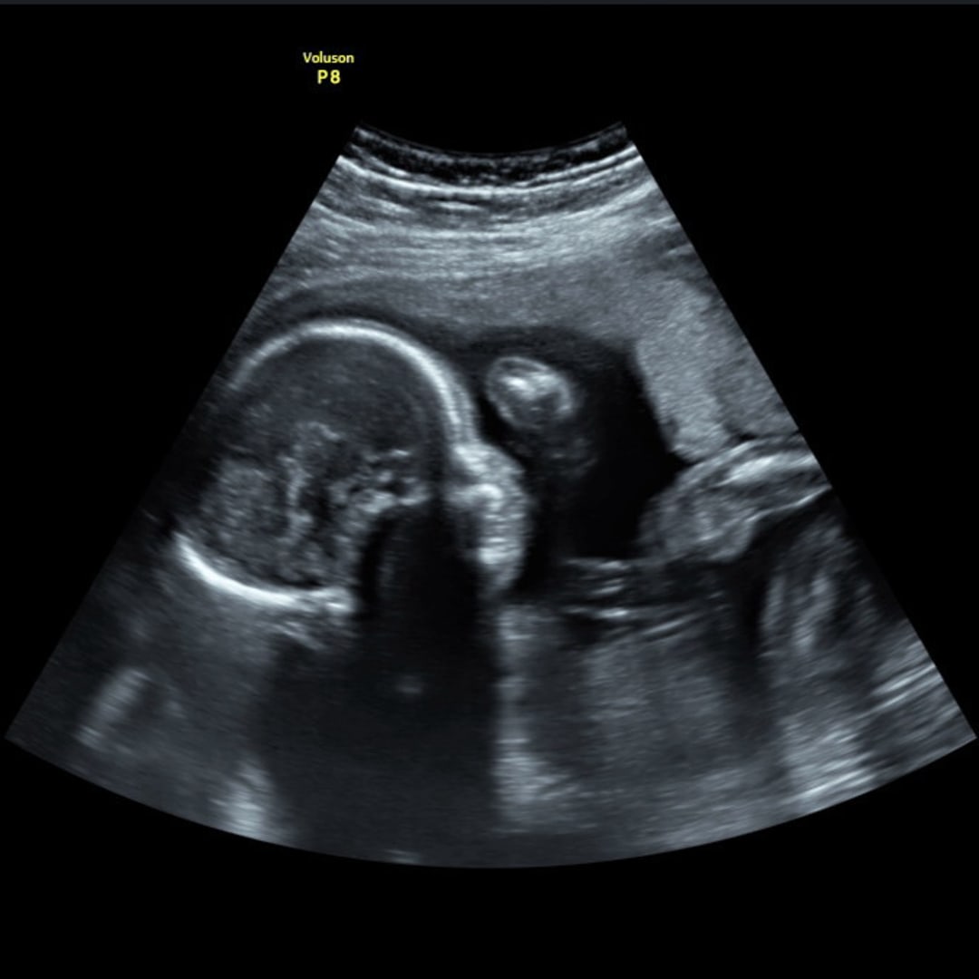 Photo shared by Erikah for their Babylist baby registry.