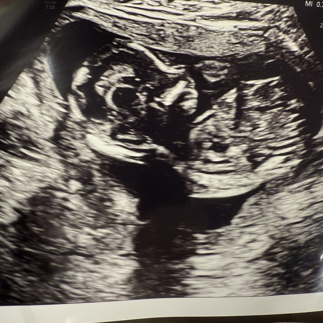 Photo shared by Fallon for their Babylist baby registry.