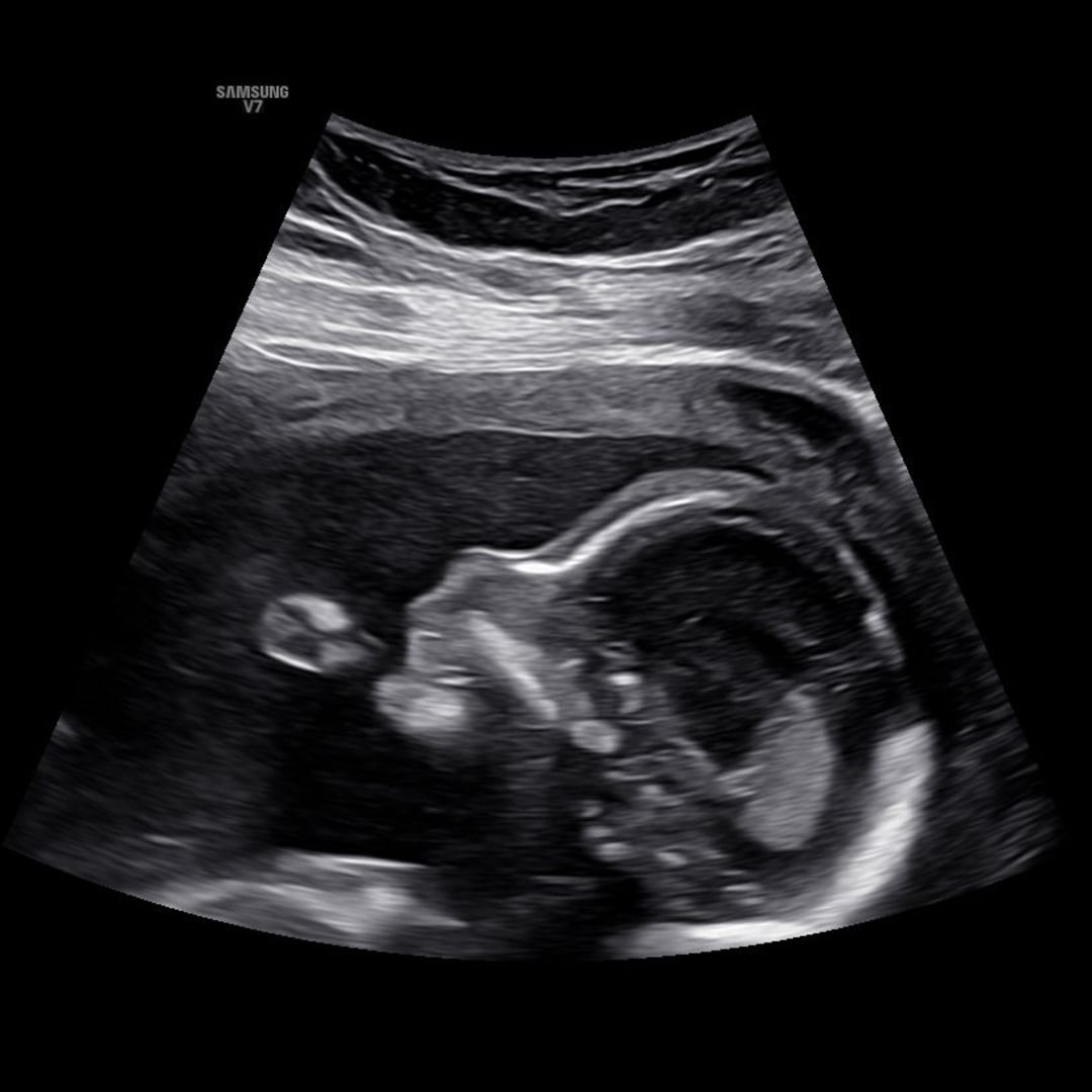Photo shared by Breanna for their Babylist baby registry.