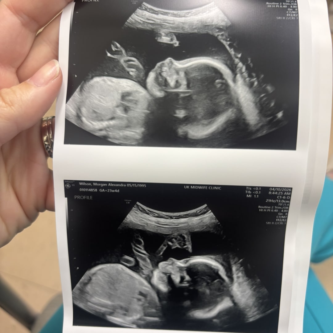 Photo shared by Morgan for their Babylist baby registry.