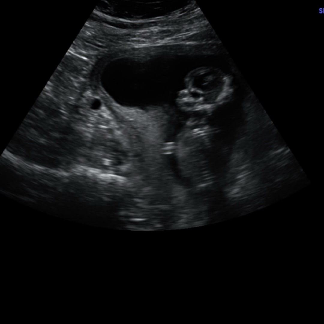 Photo shared by Anjenette for their Babylist baby registry.