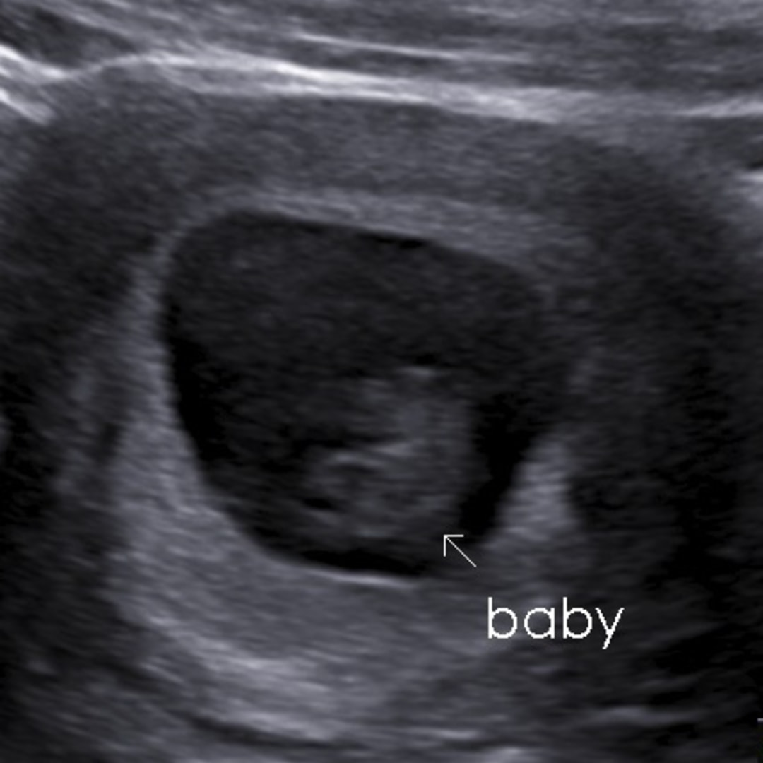 Photo shared by Maria for their Babylist baby registry.