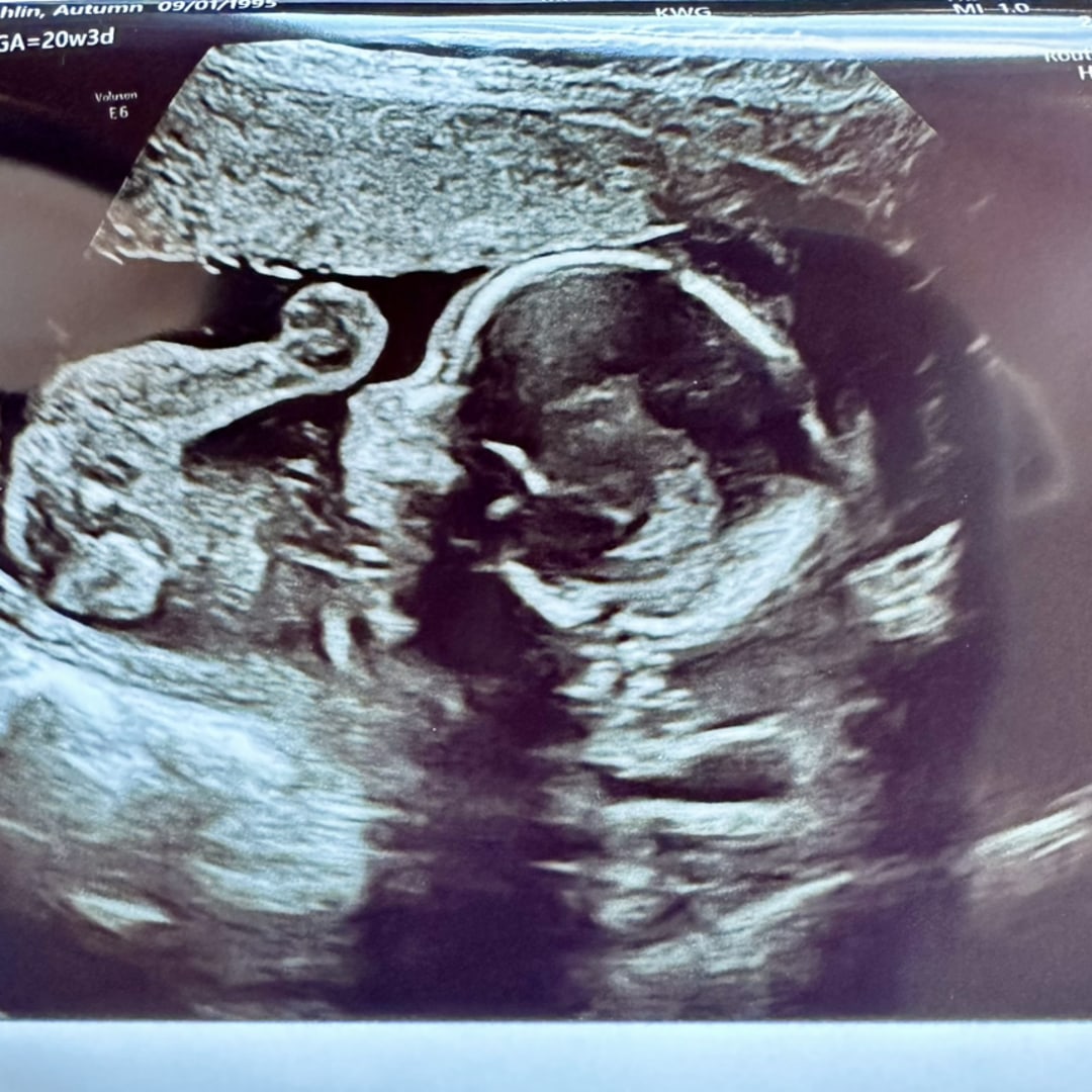 Photo shared by Autumn for their Babylist baby registry.