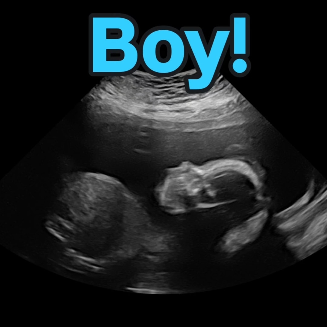 Photo shared by Bella for their Babylist baby registry.