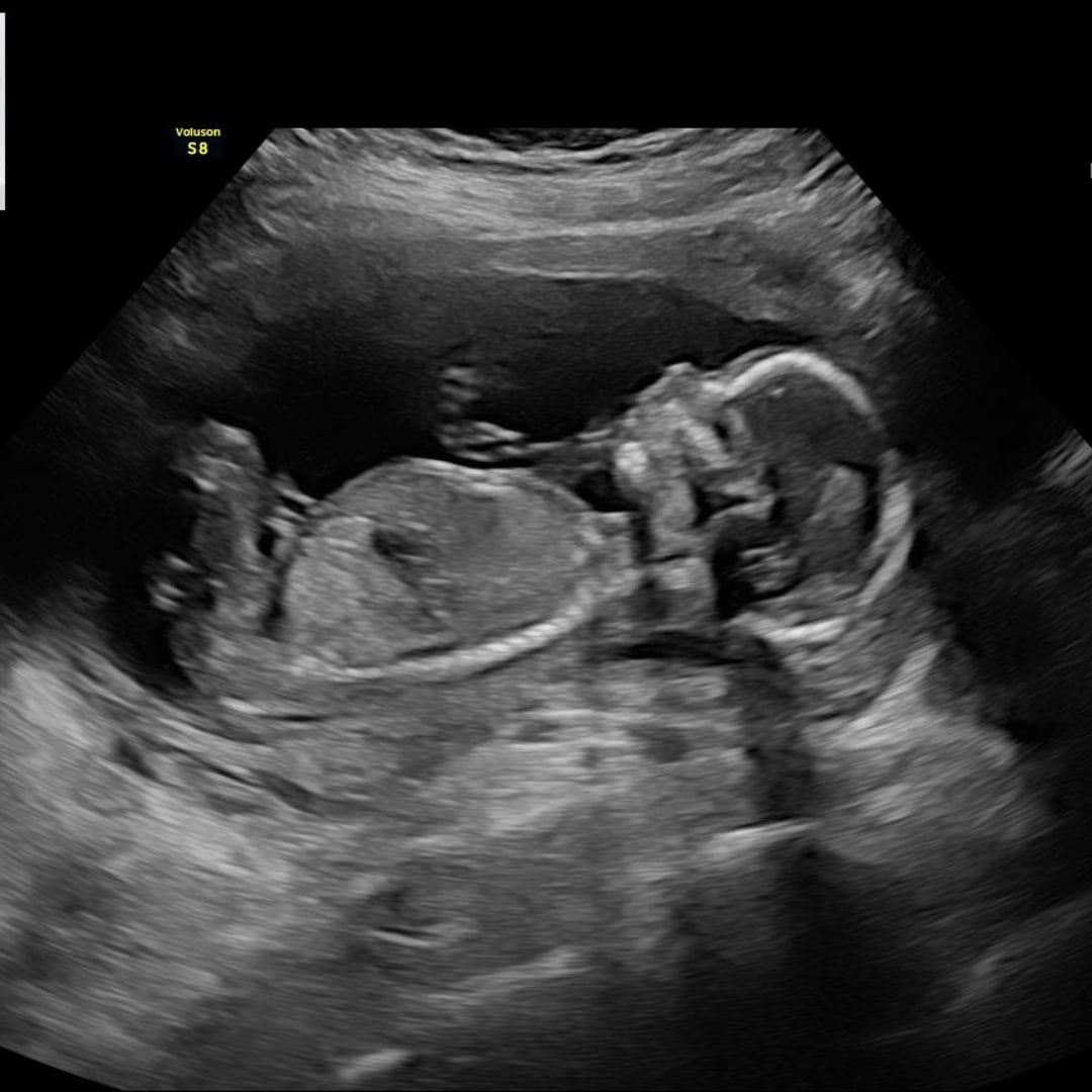 Photo shared by Allyson for their Babylist baby registry.
