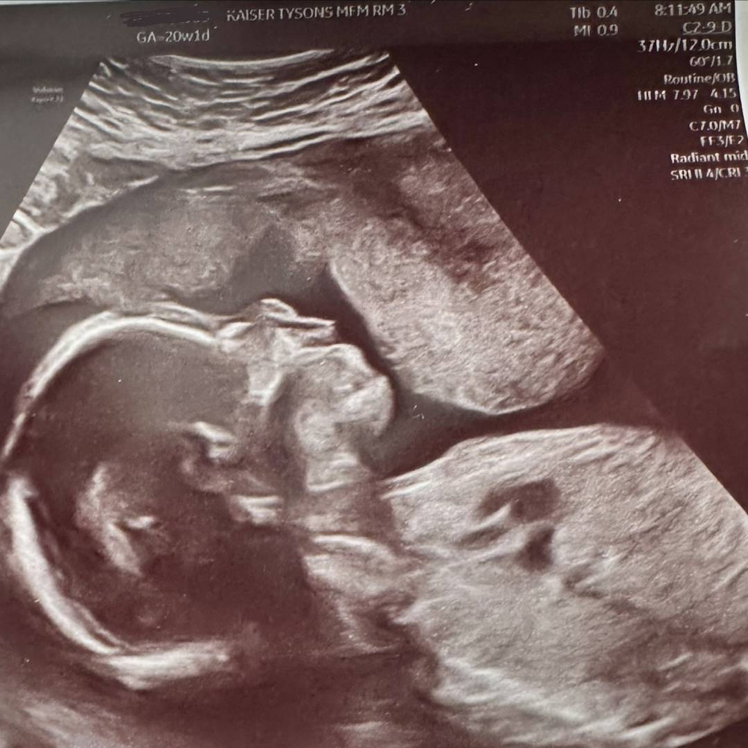 Photo shared by Alanna for their Babylist baby registry.