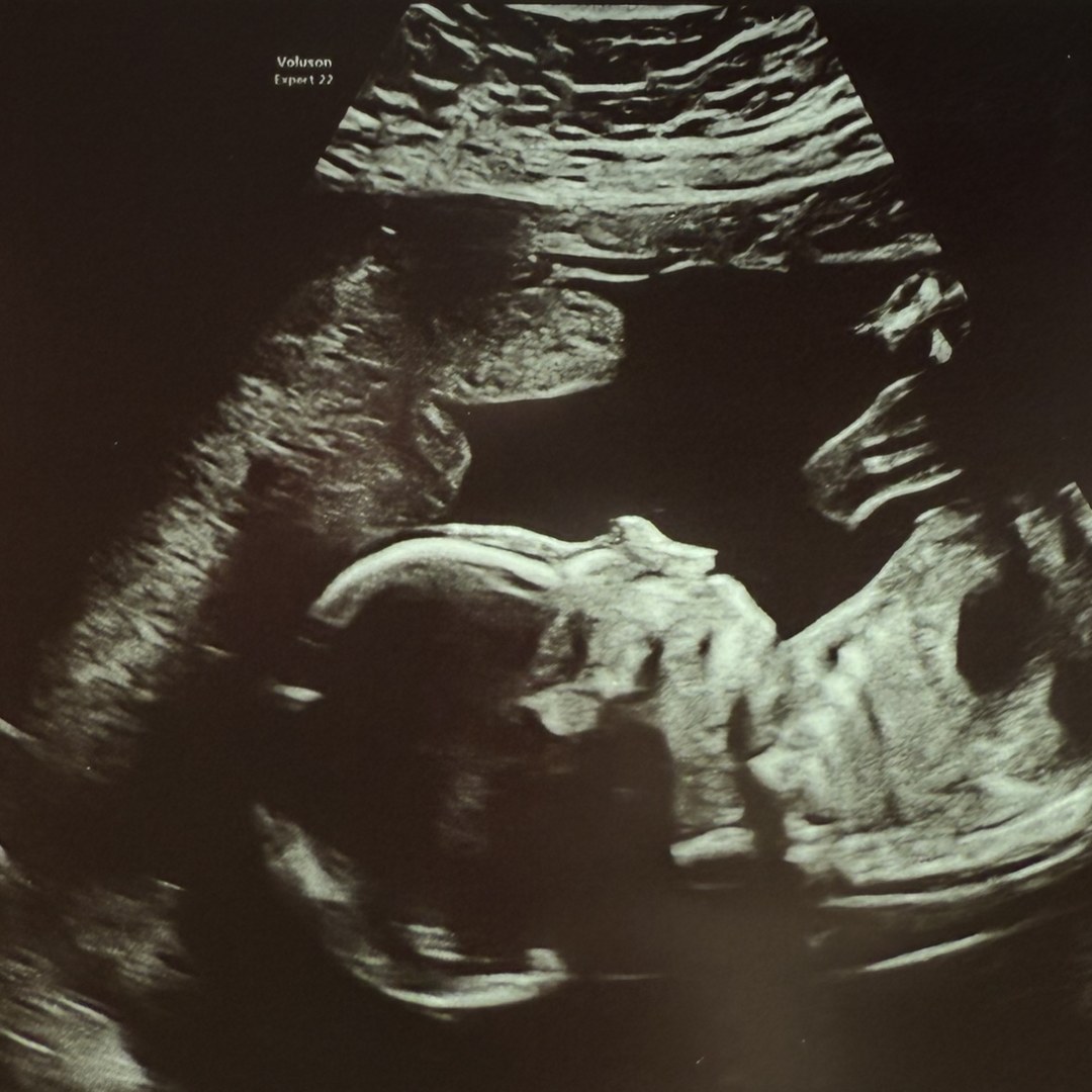 Photo shared by Olivia for their Babylist baby registry.