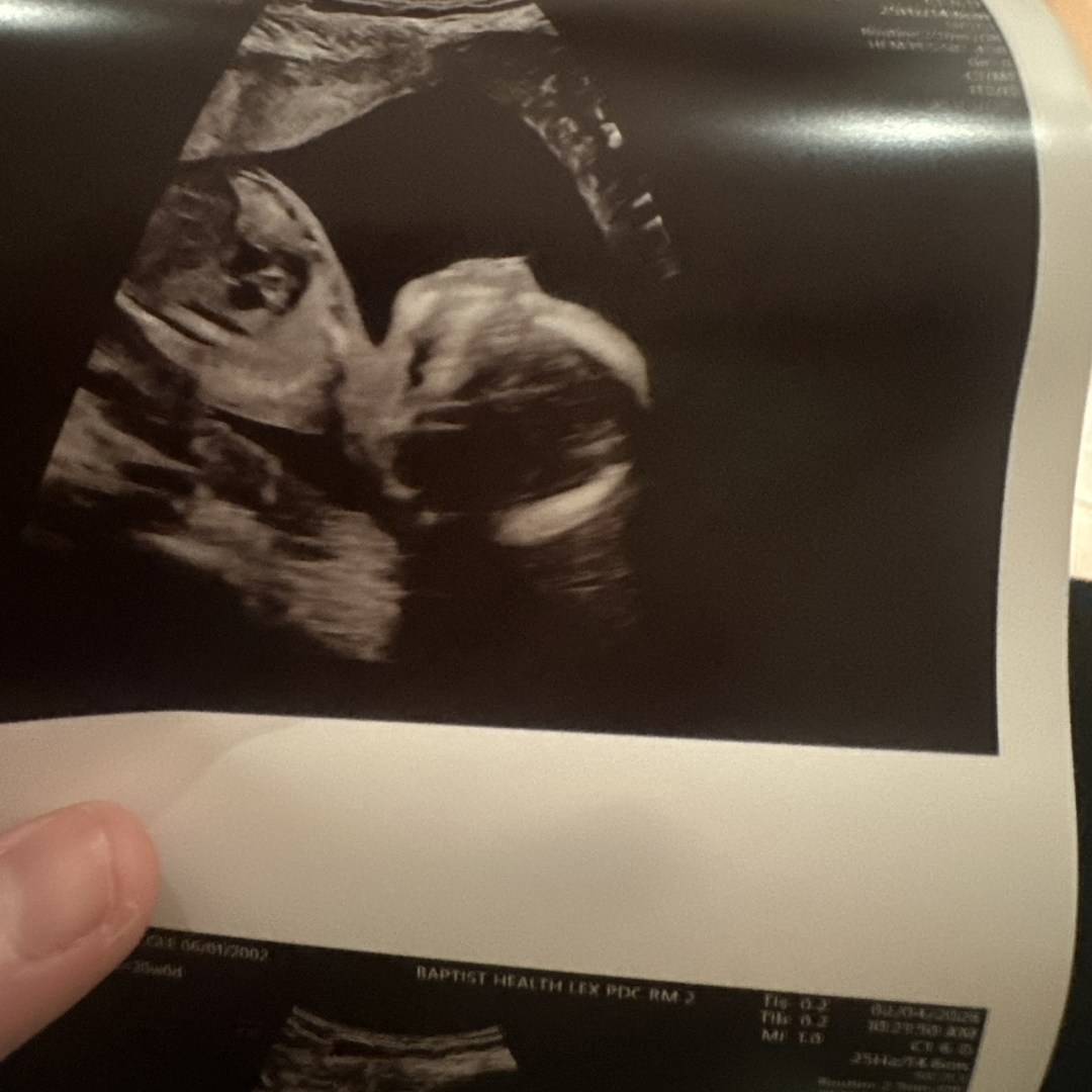 Photo shared by Emilee for their Babylist baby registry.