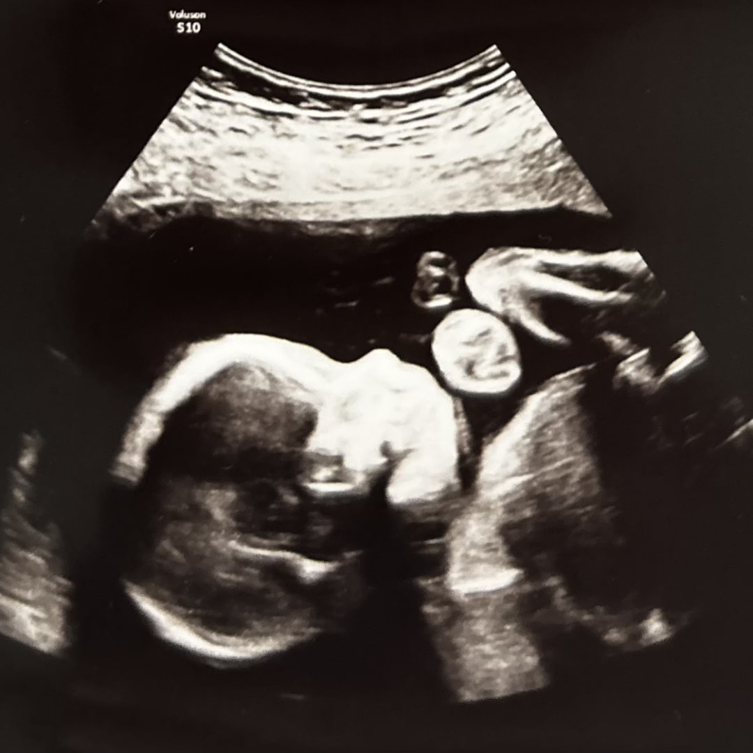 Photo shared by Lennon and Eliana for their Babylist baby registry.