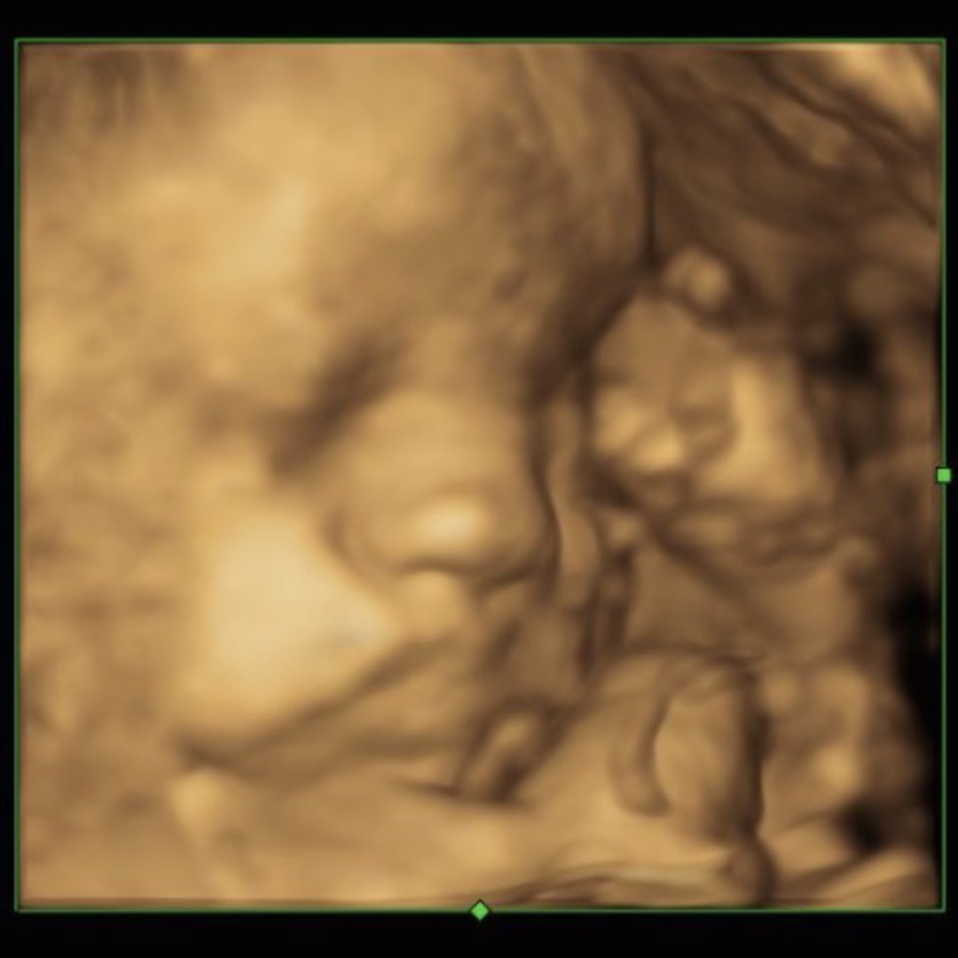 Photo shared by Ashley for their Babylist baby registry.