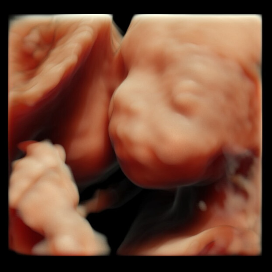 Photo shared by Lauren for their Babylist baby registry.