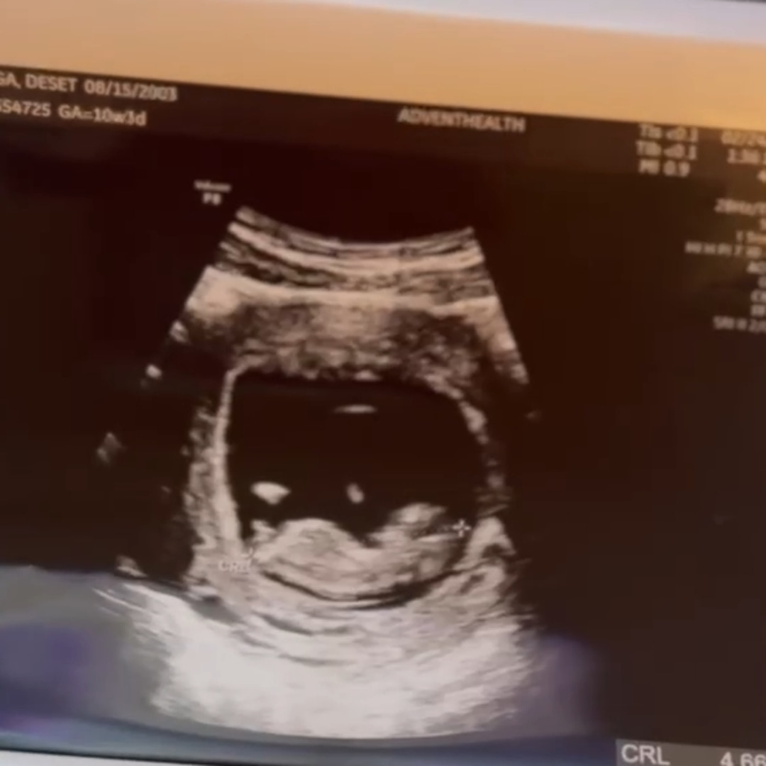 Photo shared by Deset for their Babylist baby registry.